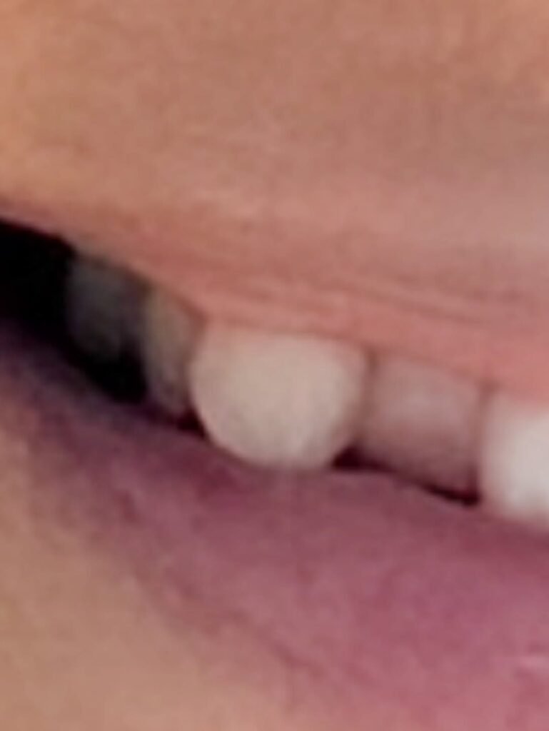 Jewels Snaggletooth Is Living Its Best Life According To Jewel Jewel Bikini Tooth 4